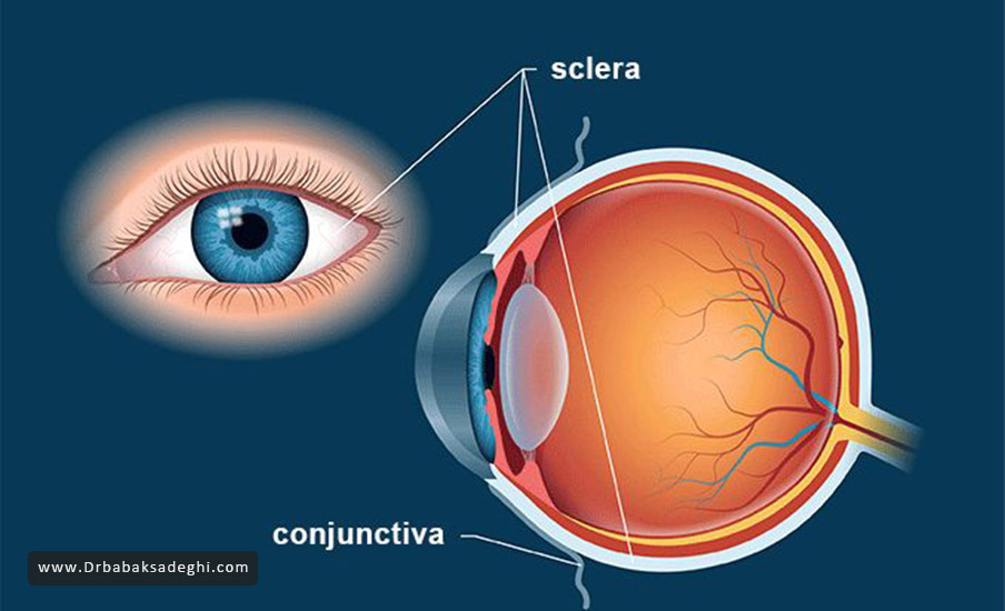صلبیه (Sclera) یا سفیدی چشم