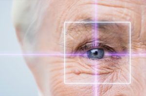 Presbyopia treatment with LASIK