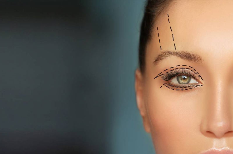 جراحی زیبایی چشم و مزایای آن