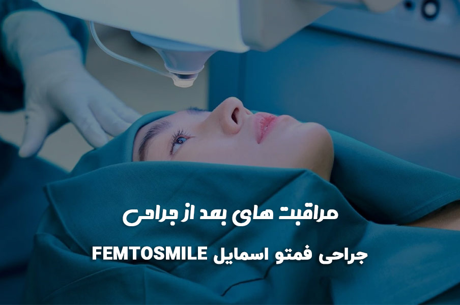 مراقبت‌های بعد از جراحی فمتو اسمایل (Femto SMILE)