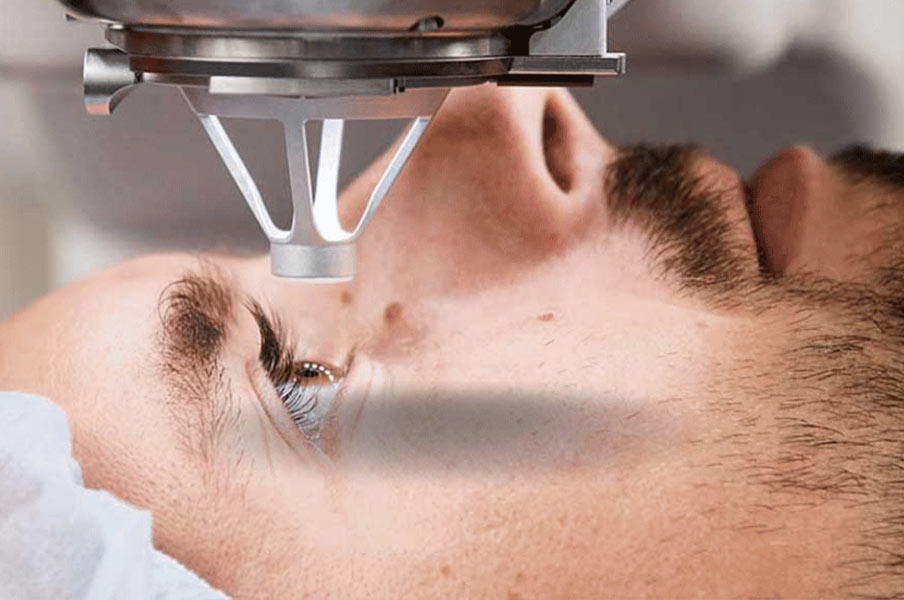 فمتو لیزیک چیست؟ همه چیز درباره عمل فمتو لیزیک چشم